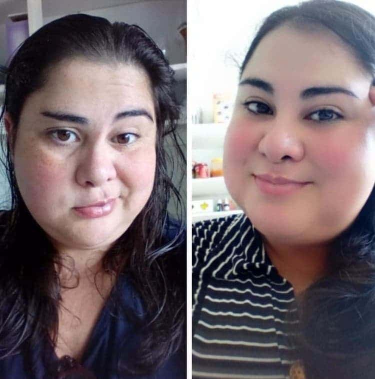 Before and after Access Energetic Facelift sessions — remarkable results for Bell's Paralysis