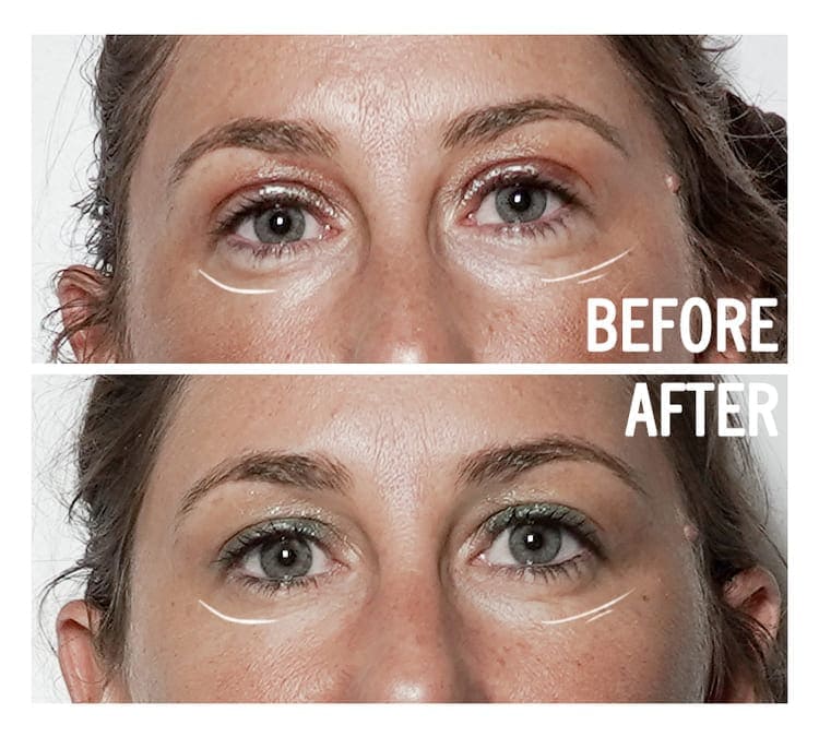 Access Energetic Facelift before and after results — natural anti-ageing sessions London