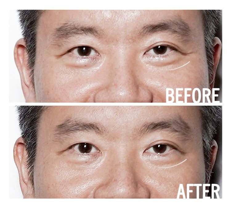 Access Energetic Facelift before and after results — natural anti-ageing sessions London