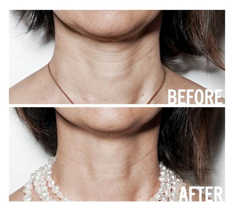 Access Energetic Facelift before and after results — natural anti-ageing sessions London